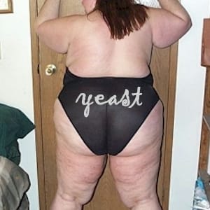 back of fat woman with vaginal yeast